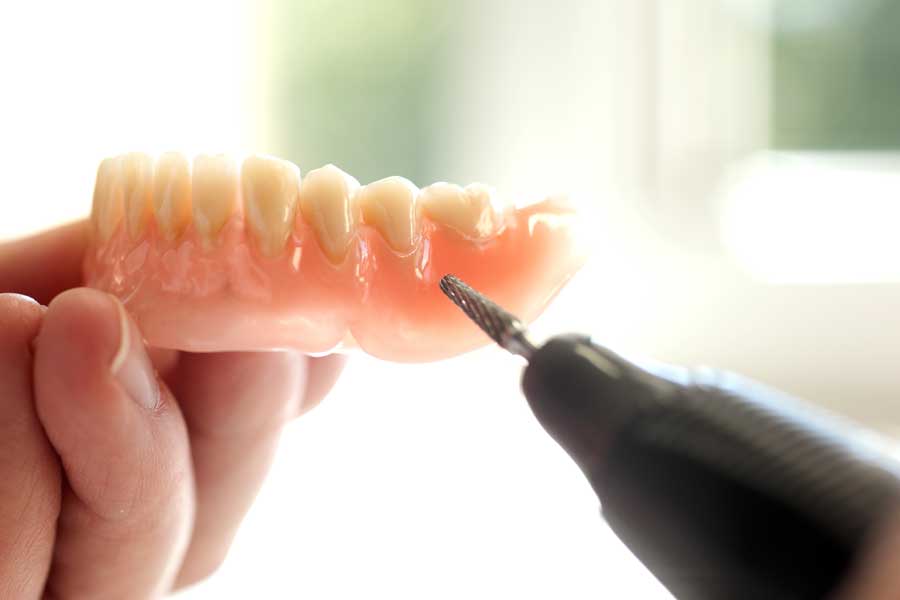 Dental Implants